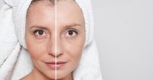 10 Stappen om voor de Huid op Je Gezicht te Zorgen