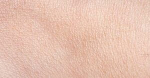 Leer de Huid Beter Kennen (de Opperhuid Editie)