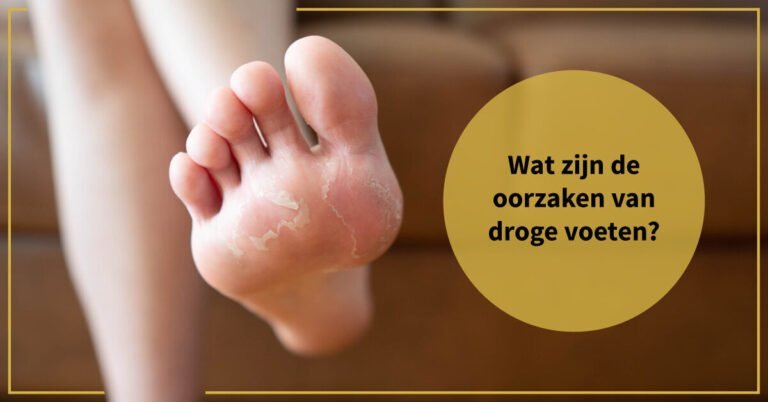 Droge Voeten: Alles over de Oorzaken & Beste Behandeling [DIY]