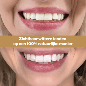 Alternative view of Oil Pulling Tanden Bleken - 250ml