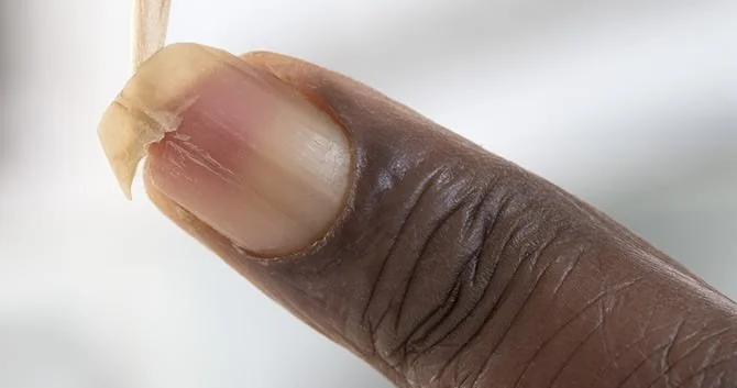 nagels-en-voedseltekorten2
