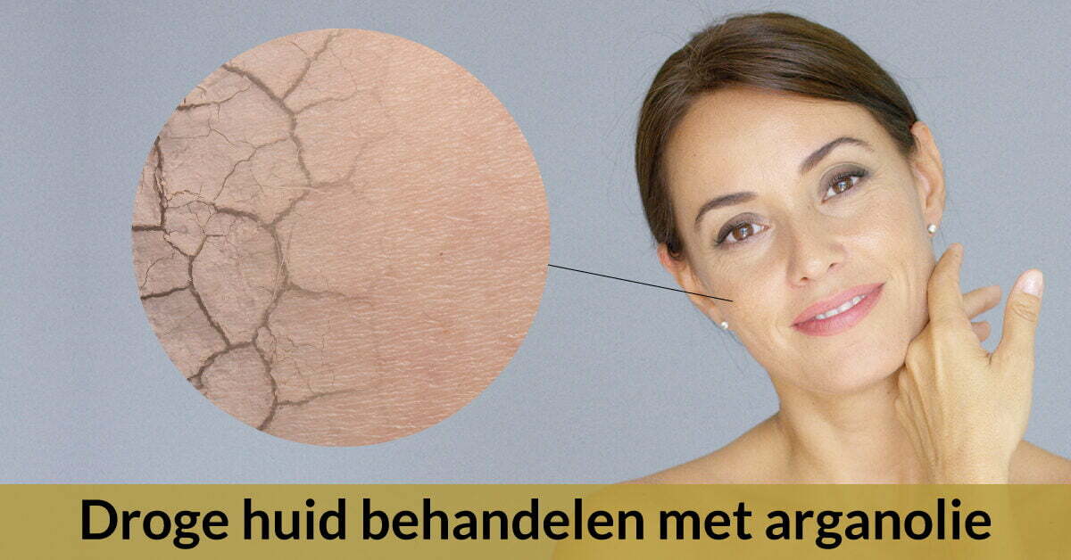 schoolbord Productiviteit gesprek Arganolie tegen een droge huid kopen? | ArganWinkel.nl